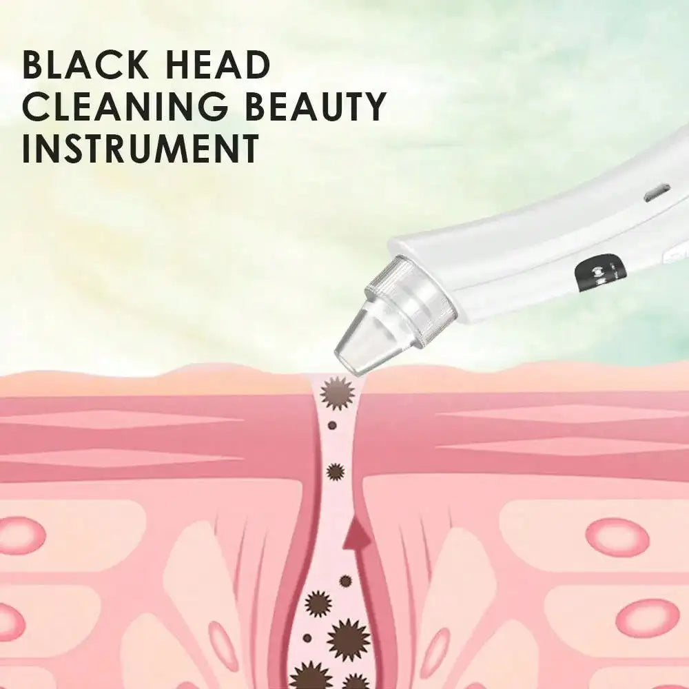 Dead Skin / Blackhead Remover face Vacuum